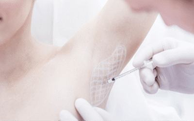 HIPERHIDROSIS AXILAR: ¿QUÉ SOLUCIÓN PROPONE LA MEDICINA ESTÉTICA?