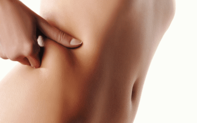 PRIMEROS CUIDADOS PARA NUESTRO CUERPO: CARBOXITERAPIA