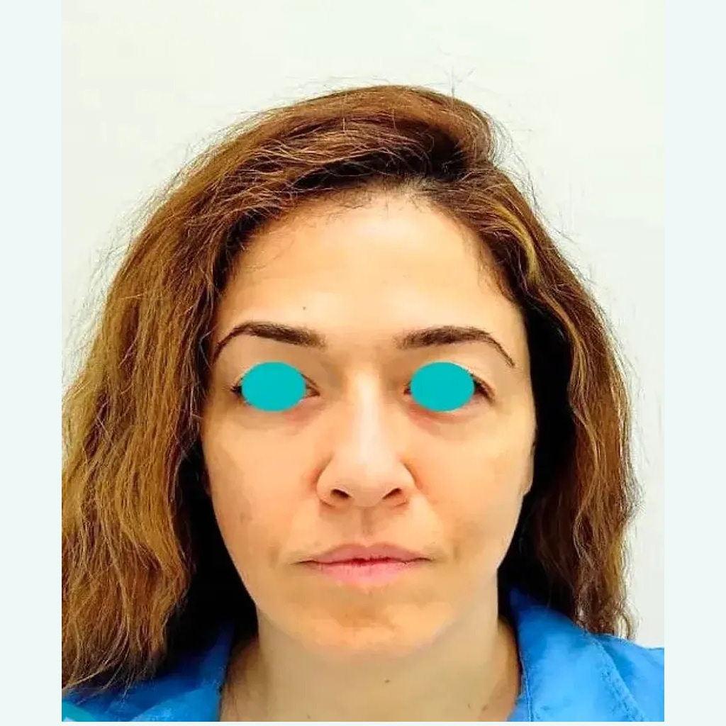 Caso 2 después